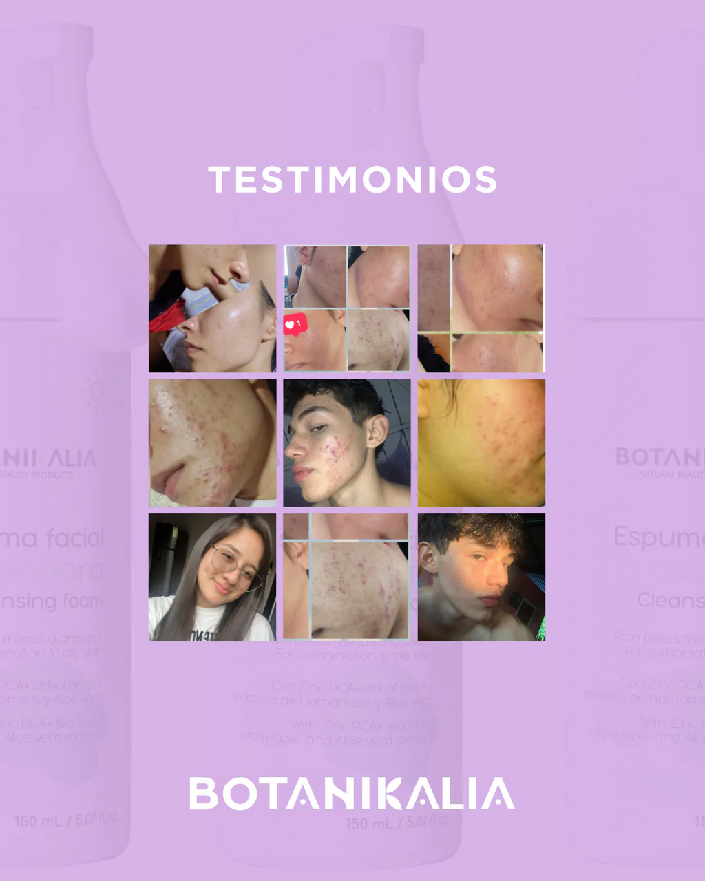 RETO DILE ADIÓS AL ACNÉ